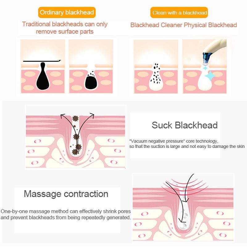 Pore Vacuum Blackhead Remover Suction Acne Peeling Pore Face Cleanser